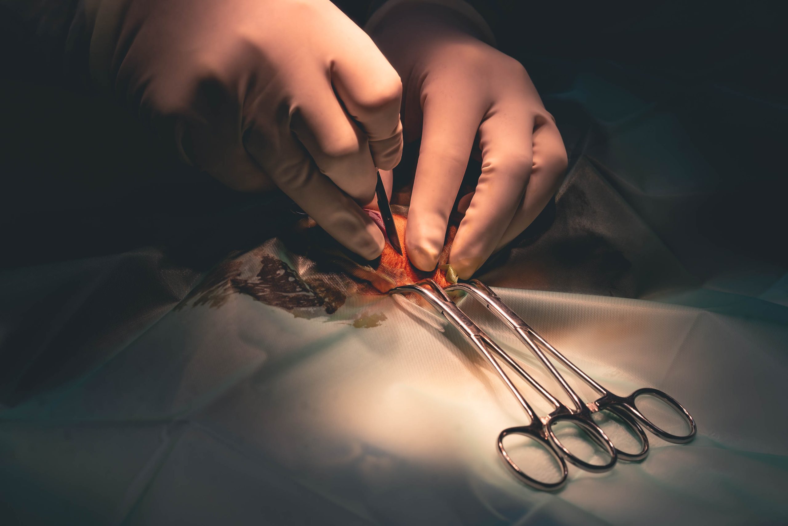 chirurgie