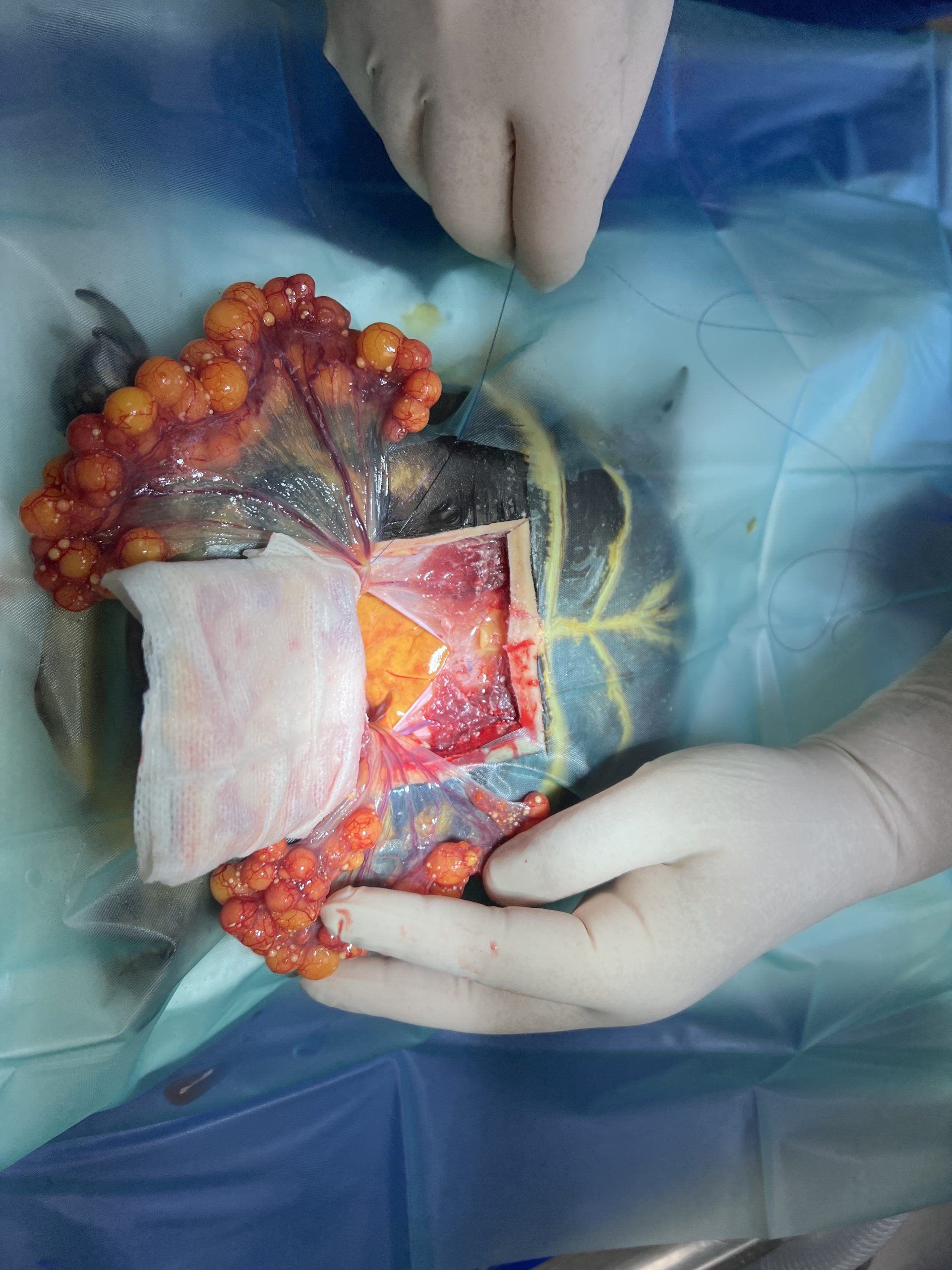 chirurgie