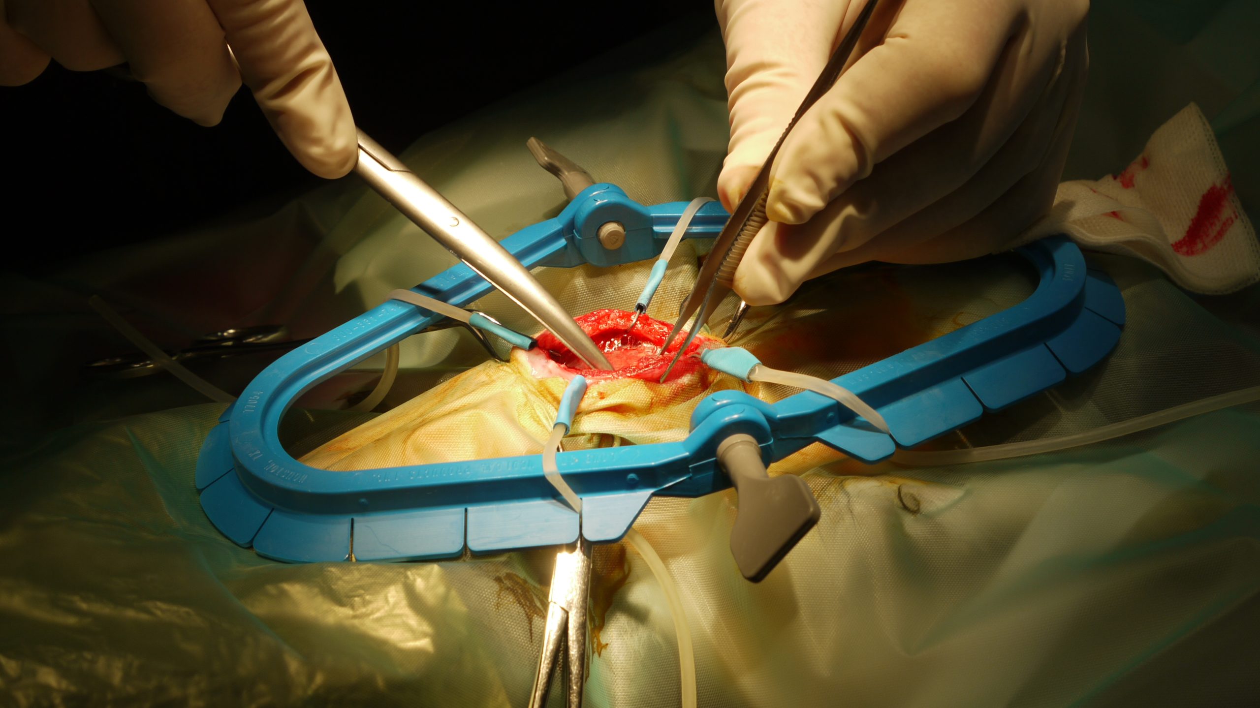 chirurgie