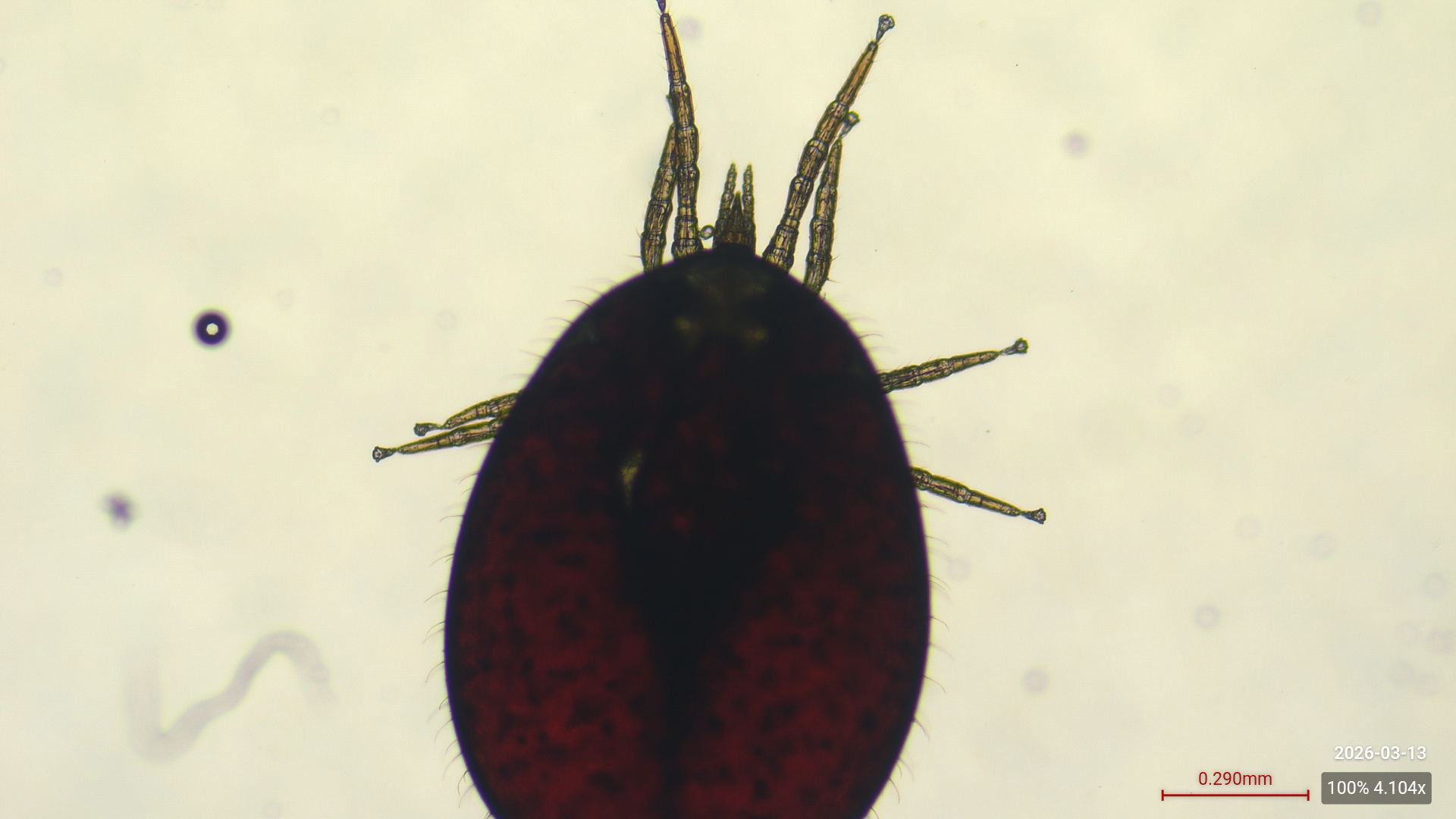 analyse parasitaire