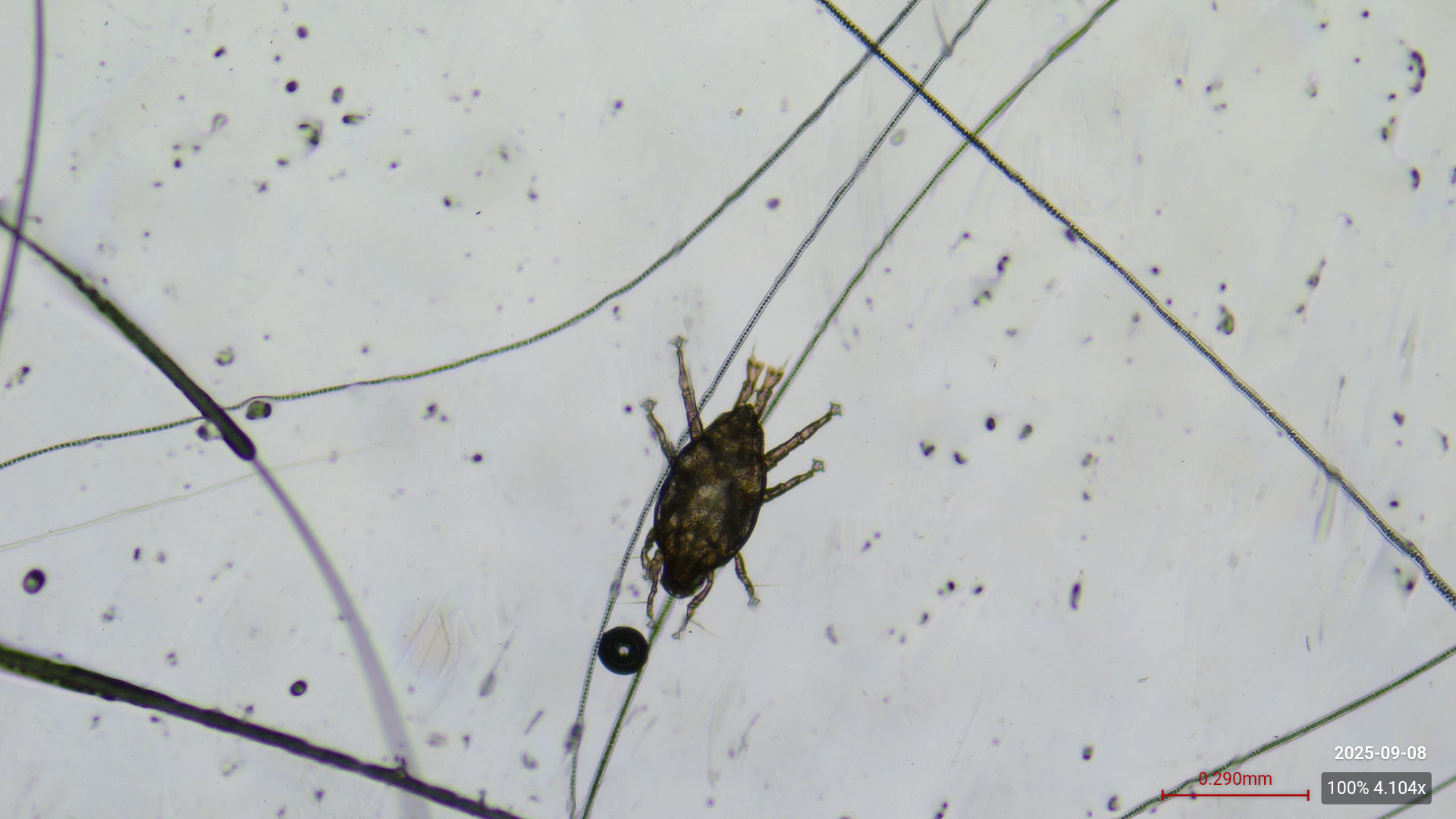 analyse parasitaire